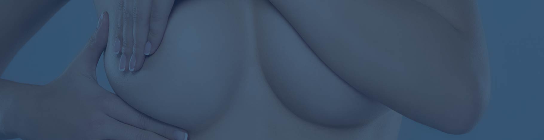 COSMETIC BREAST SURGERY