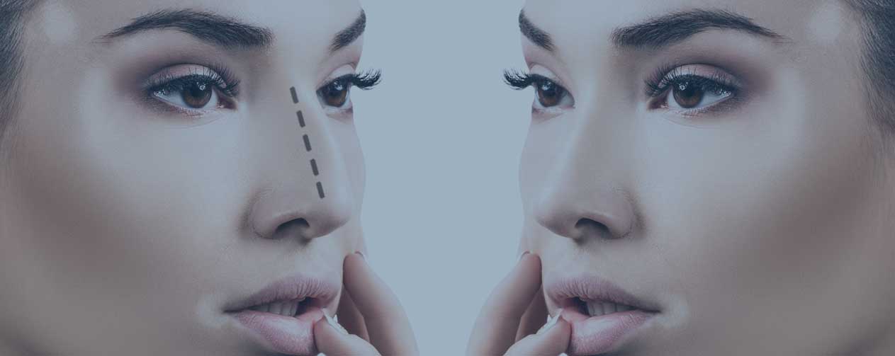 YOU ARE AT THE RIGHT ADDRESS FOR THE RHINOPLASTY PROCEDURE YOU HAVE BEEN CONSIDERING FOR A LONG TIME.